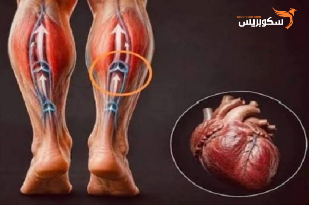عضلات الساق... قلب ثاني في جسم الانسان